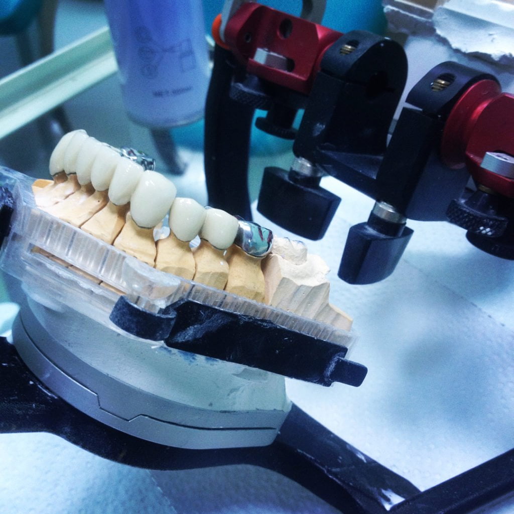 Артикулятор