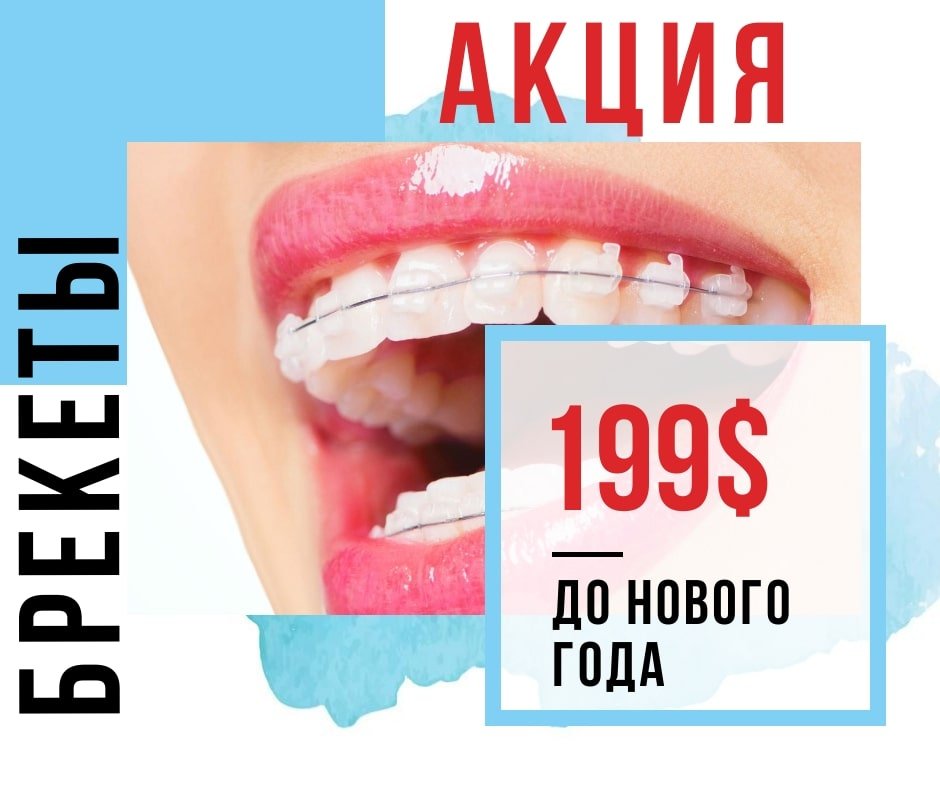 Акция на брекеты Одесса