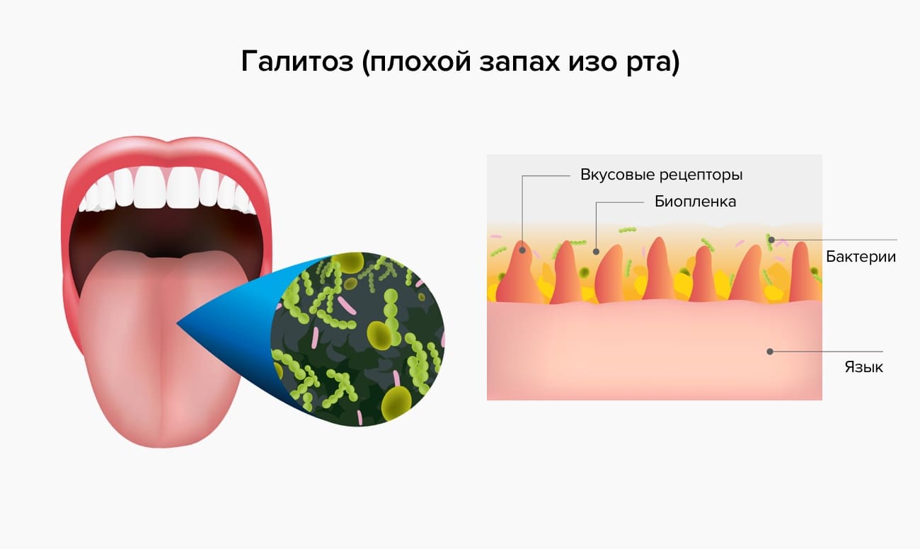запах изо рта