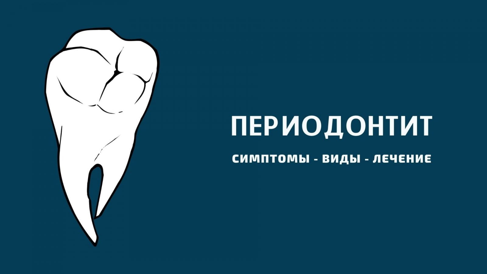 Периодонтит