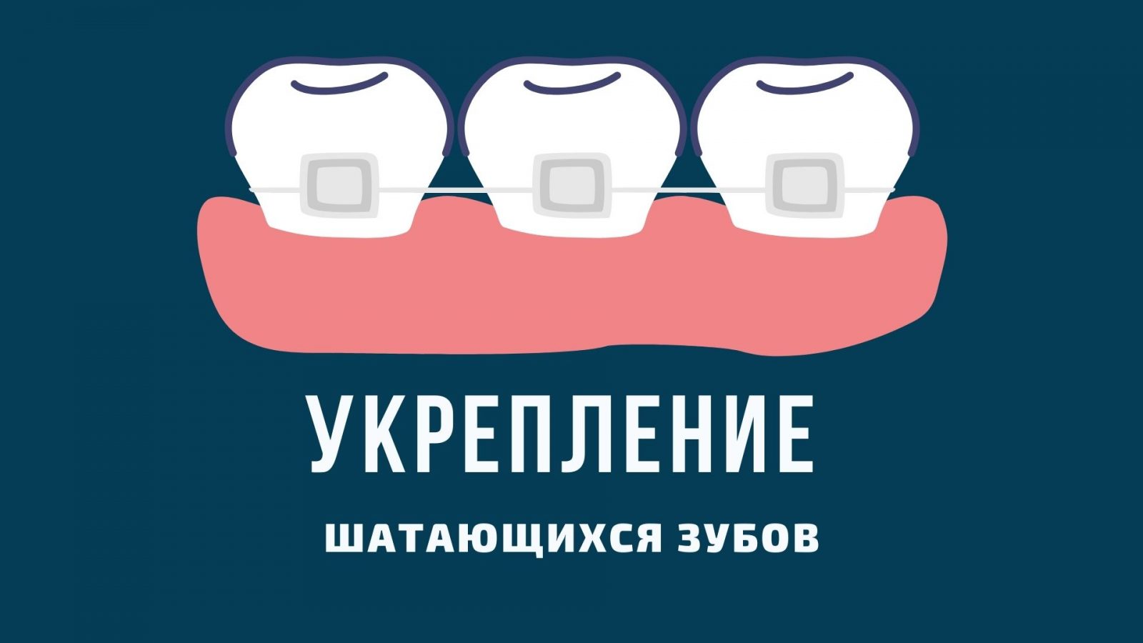 Как спасти шатающийся зуб от удаления