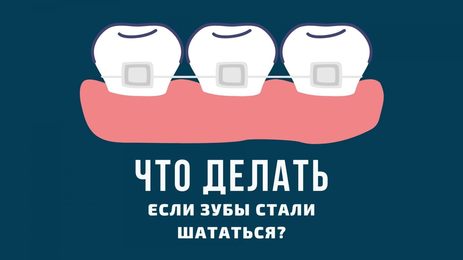 Что делать, если зубы стали шататься?