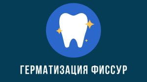 Герметизация фиссур зубов у детей и взрослых