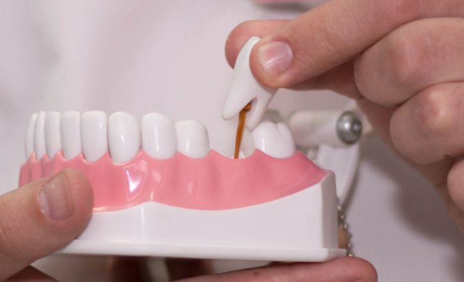 Ортопедия в стоматологии. Цены на зубную ортопедию в Одессе